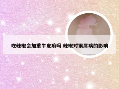 吃辣椒会加重牛皮癣吗 辣椒对银屑病的影响