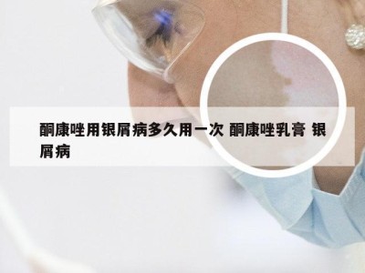 酮康唑用银屑病多久用一次 酮康唑乳膏 银屑病