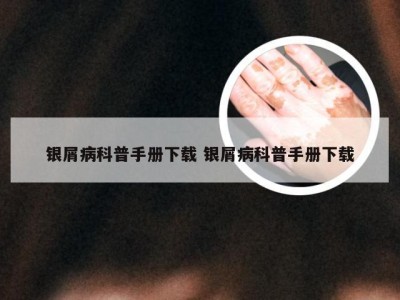 银屑病科普手册下载 银屑病科普手册下载