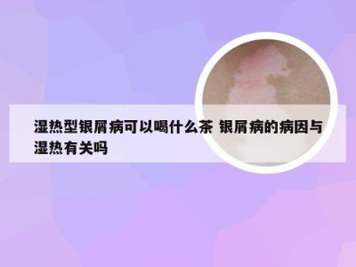 湿热型银屑病可以喝什么茶 银屑病的病因与湿热有关吗
