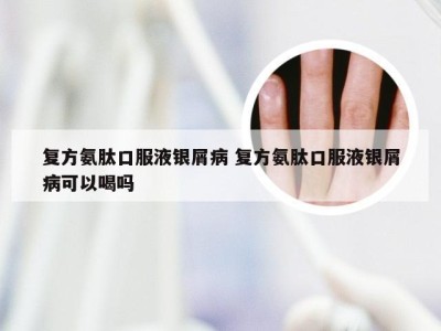 复方氨肽口服液银屑病 复方氨肽口服液银屑病可以喝吗