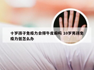 十岁孩子免疫力会得牛皮癣吗 10岁男孩免疫力低怎么办
