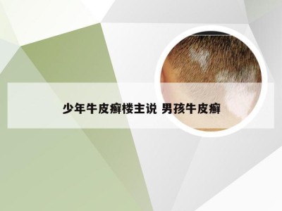 少年牛皮癣楼主说 男孩牛皮癣