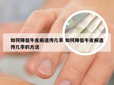 如何降低牛皮癣遗传几率 如何降低牛皮癣遗传几率的方法