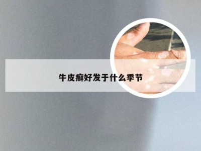 牛皮癣好发于什么季节