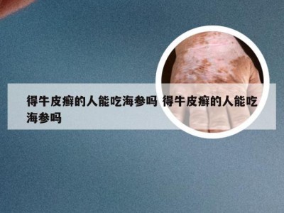得牛皮癣的人能吃海参吗 得牛皮癣的人能吃海参吗