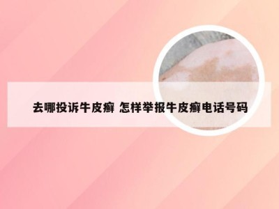 去哪投诉牛皮癣 怎样举报牛皮癣电话号码