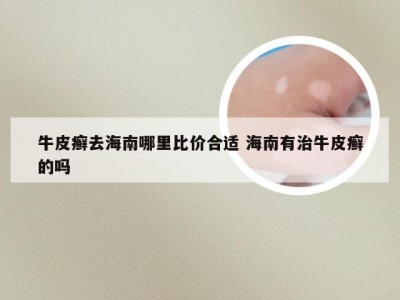 牛皮癣去海南哪里比价合适 海南有治牛皮癣的吗
