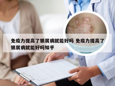 免疫力提高了银屑病就能好吗 免疫力提高了银屑病就能好吗知乎