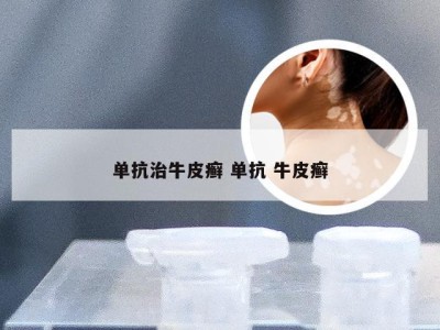 单抗治牛皮癣 单抗 牛皮癣