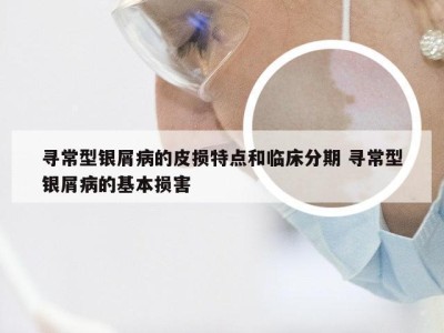 寻常型银屑病的皮损特点和临床分期 寻常型银屑病的基本损害