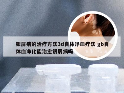 银屑病的治疗方法3d自体净血疗法 gb自体血净化能治愈银屑病吗