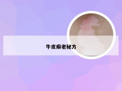 牛皮癣老秘方