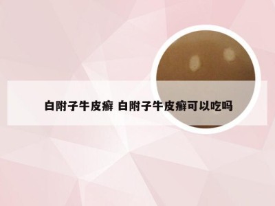 白附子牛皮癣 白附子牛皮癣可以吃吗