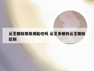 云芝糖肽银屑病能吃吗 云芝多糖和云芝糖肽区别