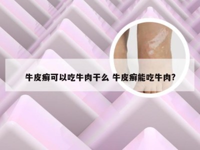 牛皮癣可以吃牛肉干么 牛皮癣能吃牛肉?