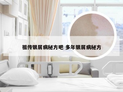 祖传银屑病秘方吧 多年银屑病秘方