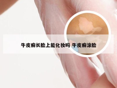 牛皮癣长脸上能化妆吗 牛皮癣涂脸