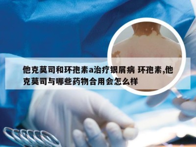 他克莫司和环孢素a治疗银屑病 环孢素,他克莫司与哪些药物合用会怎么样