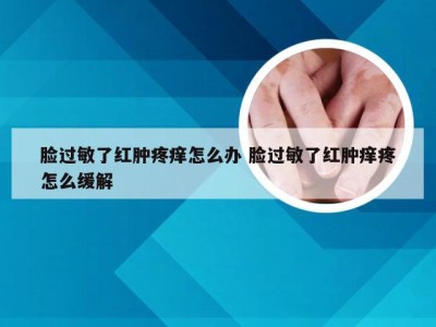 脸过敏了红肿疼痒怎么办 脸过敏了红肿痒疼怎么缓解