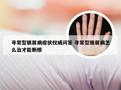 寻常型银屑病症状权威问答 寻常型银屑病怎么治才能断根