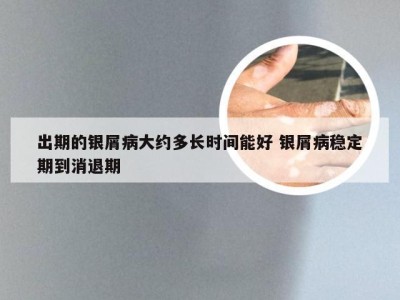 出期的银屑病大约多长时间能好 银屑病稳定期到消退期