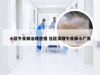 小区牛皮癣治理感悟 社区清理牛皮癣小广告