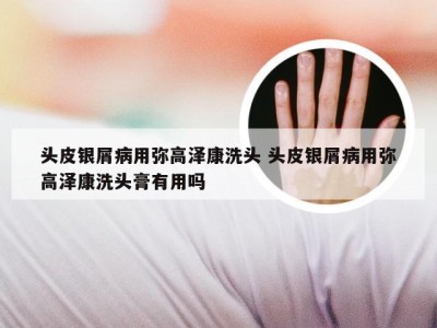 头皮银屑病用弥高泽康洗头 头皮银屑病用弥高泽康洗头膏有用吗