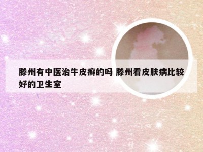 滕州有中医治牛皮癣的吗 滕州看皮肤病比较好的卫生室