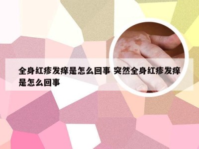 全身红疹发痒是怎么回事 突然全身红疹发痒是怎么回事