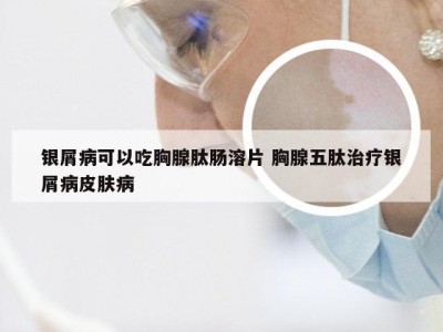 银屑病可以吃胸腺肽肠溶片 胸腺五肽治疗银屑病皮肤病