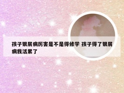 孩子银屑病厉害是不是得修学 孩子得了银屑病我活累了