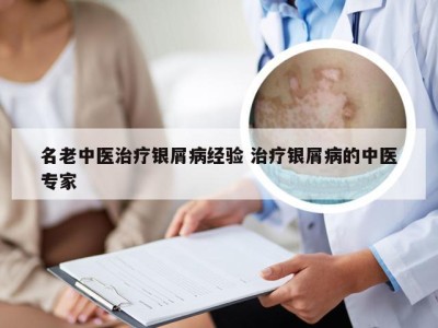 名老中医治疗银屑病经验 治疗银屑病的中医专家