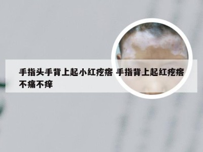 手指头手背上起小红疙瘩 手指背上起红疙瘩不痛不痒