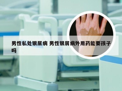 男性私处银屑病 男性银屑病外用药能要孩子吗