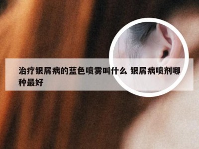 治疗银屑病的蓝色喷雾叫什么 银屑病喷剂哪种最好