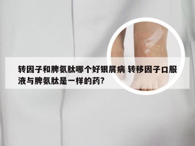 转因子和脾氨肽哪个好银屑病 转移因子口服液与脾氨肽是一样的药?