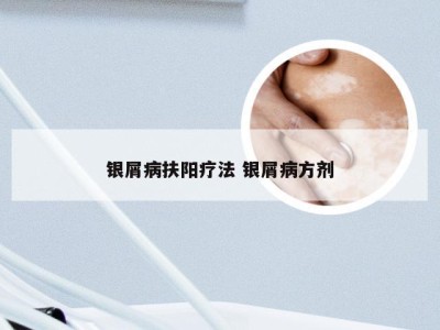 银屑病扶阳疗法 银屑病方剂