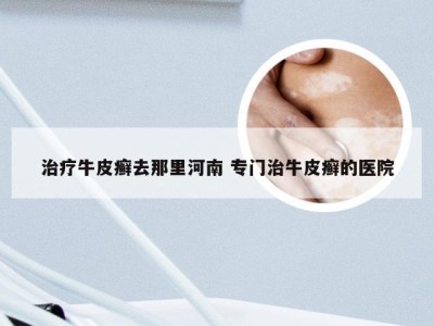 治疗牛皮癣去那里河南 专门治牛皮癣的医院