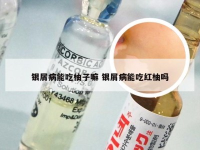银屑病能吃柚子嘛 银屑病能吃红柚吗