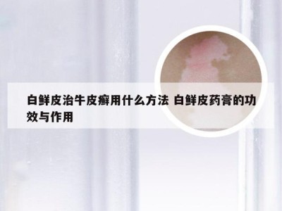 白鲜皮治牛皮癣用什么方法 白鲜皮药膏的功效与作用