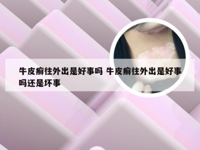 牛皮癣往外出是好事吗 牛皮癣往外出是好事吗还是坏事