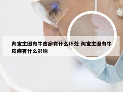 淘宝主图有牛皮癣有什么坏处 淘宝主图有牛皮癣有什么影响