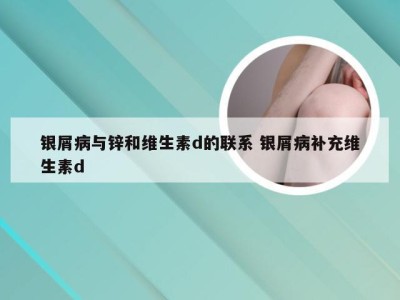 银屑病与锌和维生素d的联系 银屑病补充维生素d