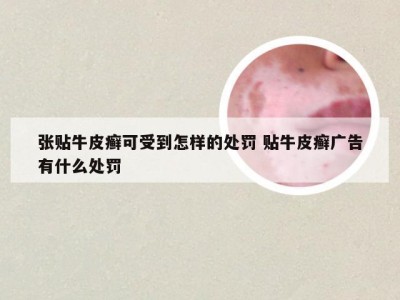 张贴牛皮癣可受到怎样的处罚 贴牛皮癣广告有什么处罚