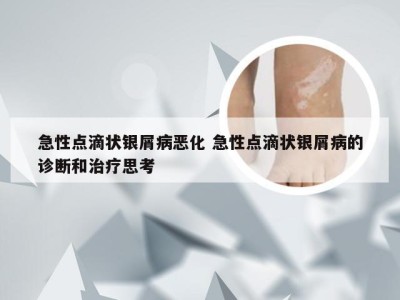 急性点滴状银屑病恶化 急性点滴状银屑病的诊断和治疗思考