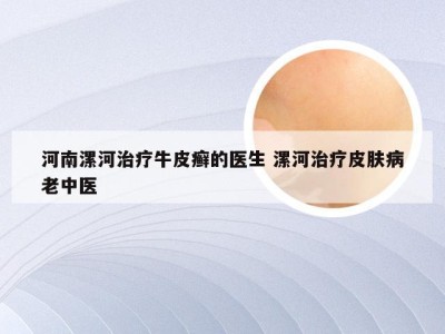 河南漯河治疗牛皮癣的医生 漯河治疗皮肤病老中医