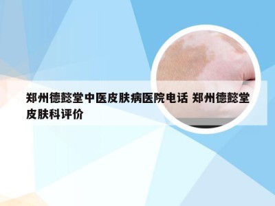 郑州德懿堂中医皮肤病医院电话 郑州德懿堂皮肤科评价