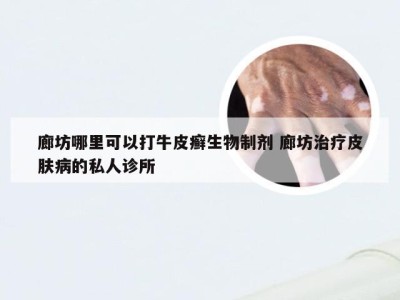 廊坊哪里可以打牛皮癣生物制剂 廊坊治疗皮肤病的私人诊所