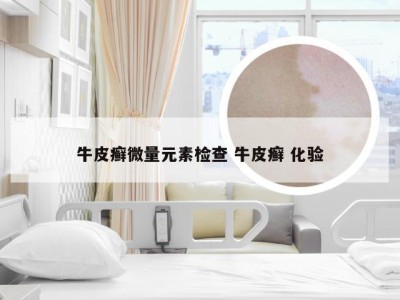 牛皮癣微量元素检查 牛皮癣 化验